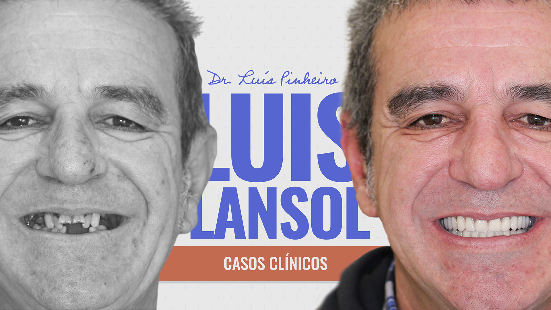 Caso Clínico – Luis Lansol