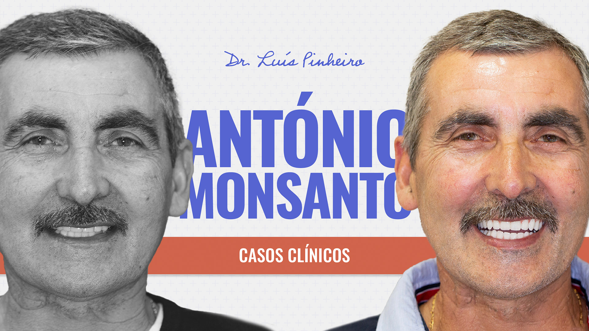 Caso clínico – António Monsanto