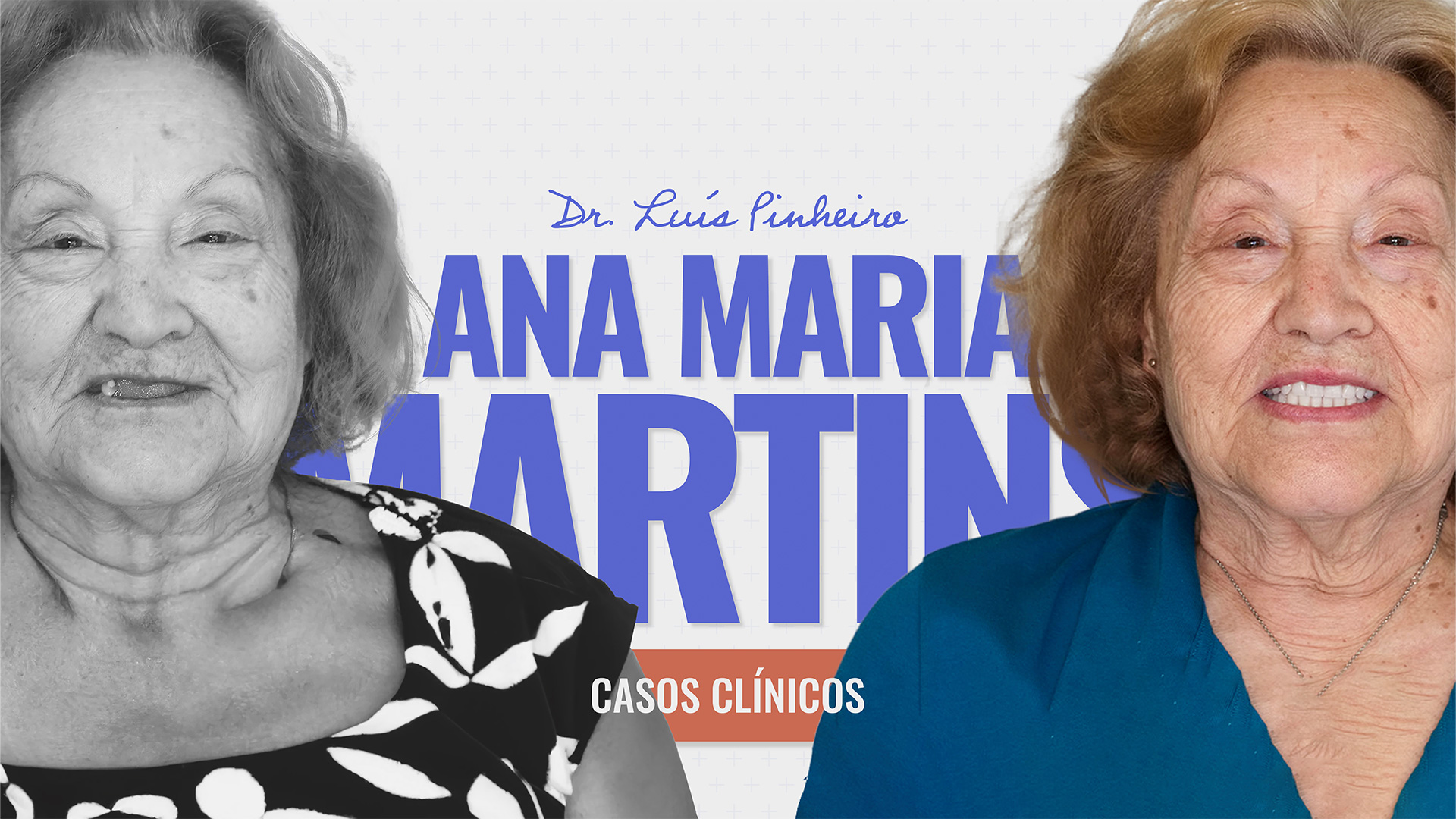 Caso Clínico – Ana Maria Martins