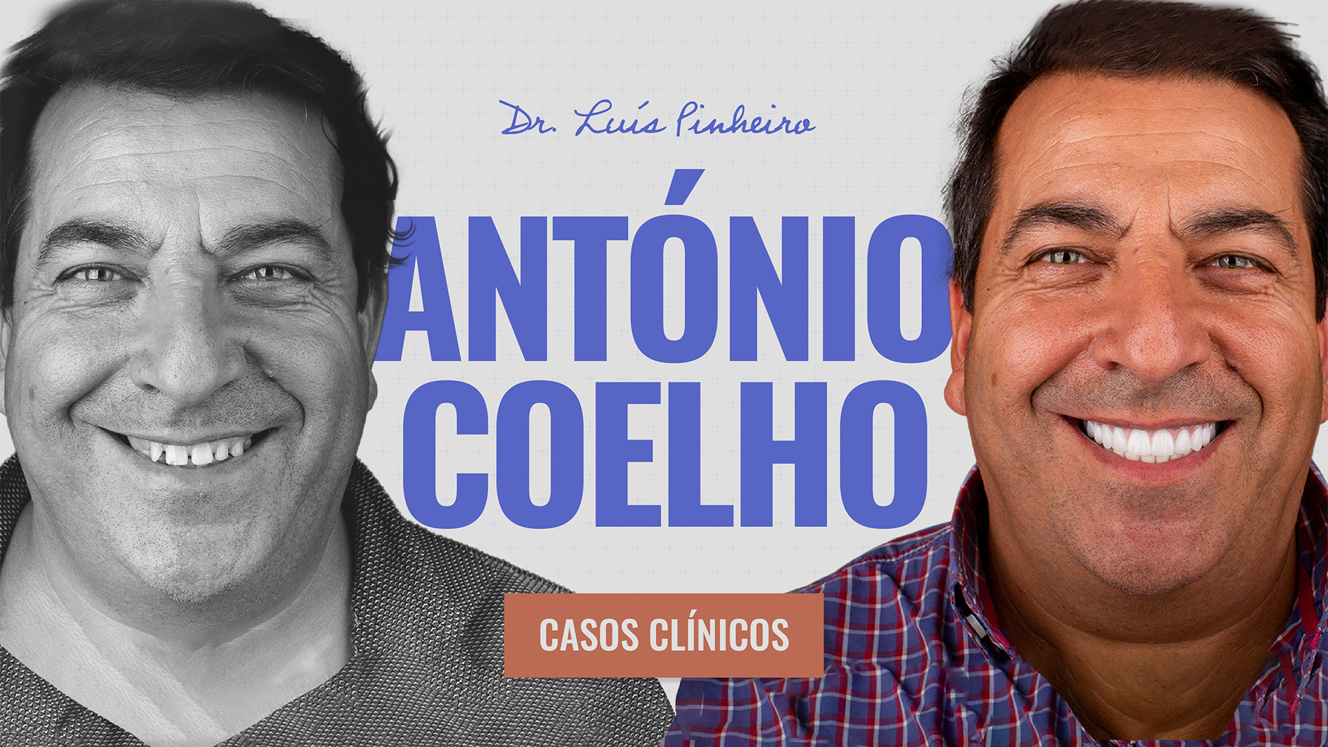 antónio coelho dentes em 1 dia