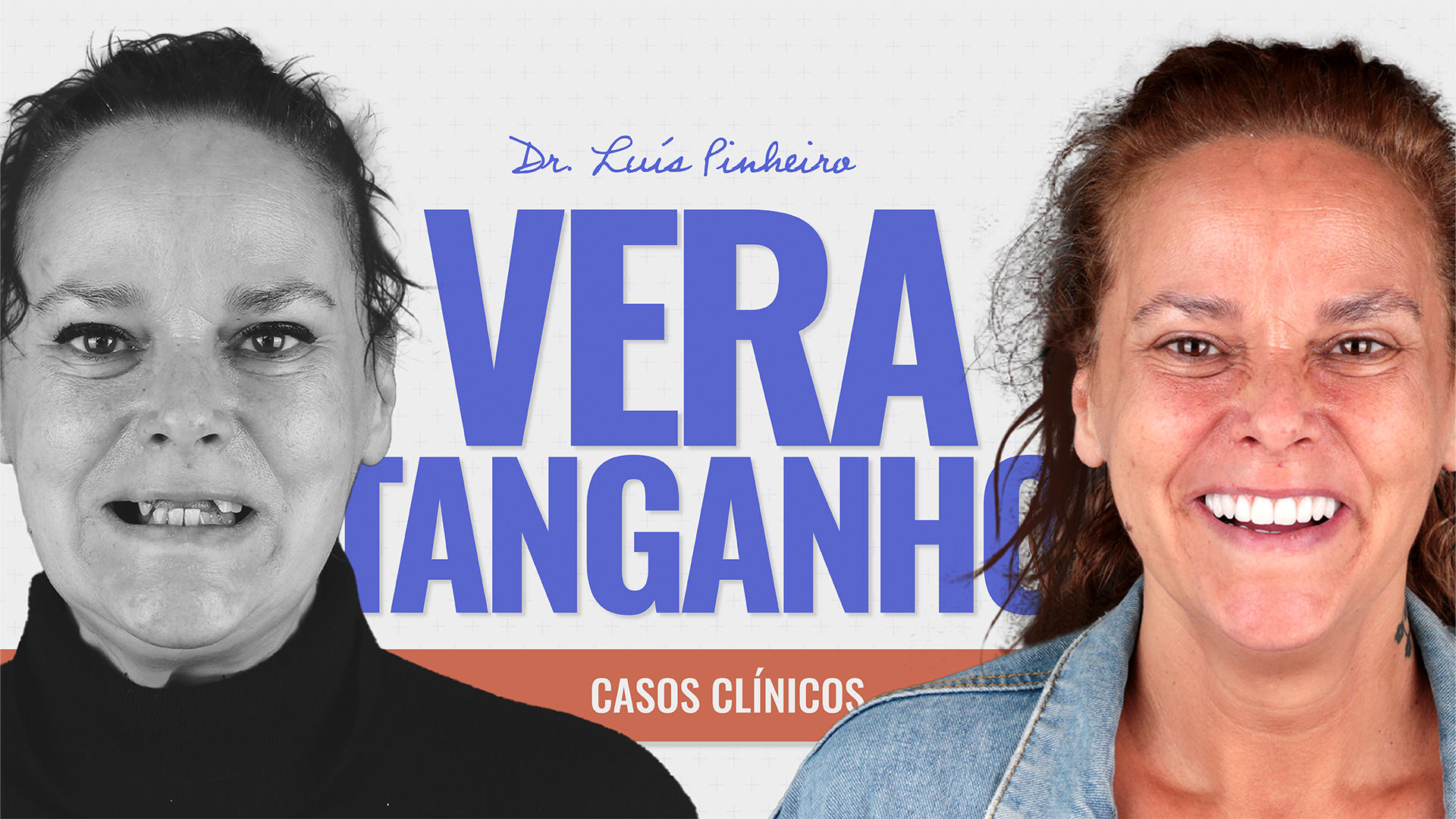 Caso Clínico – Vera Tanganho