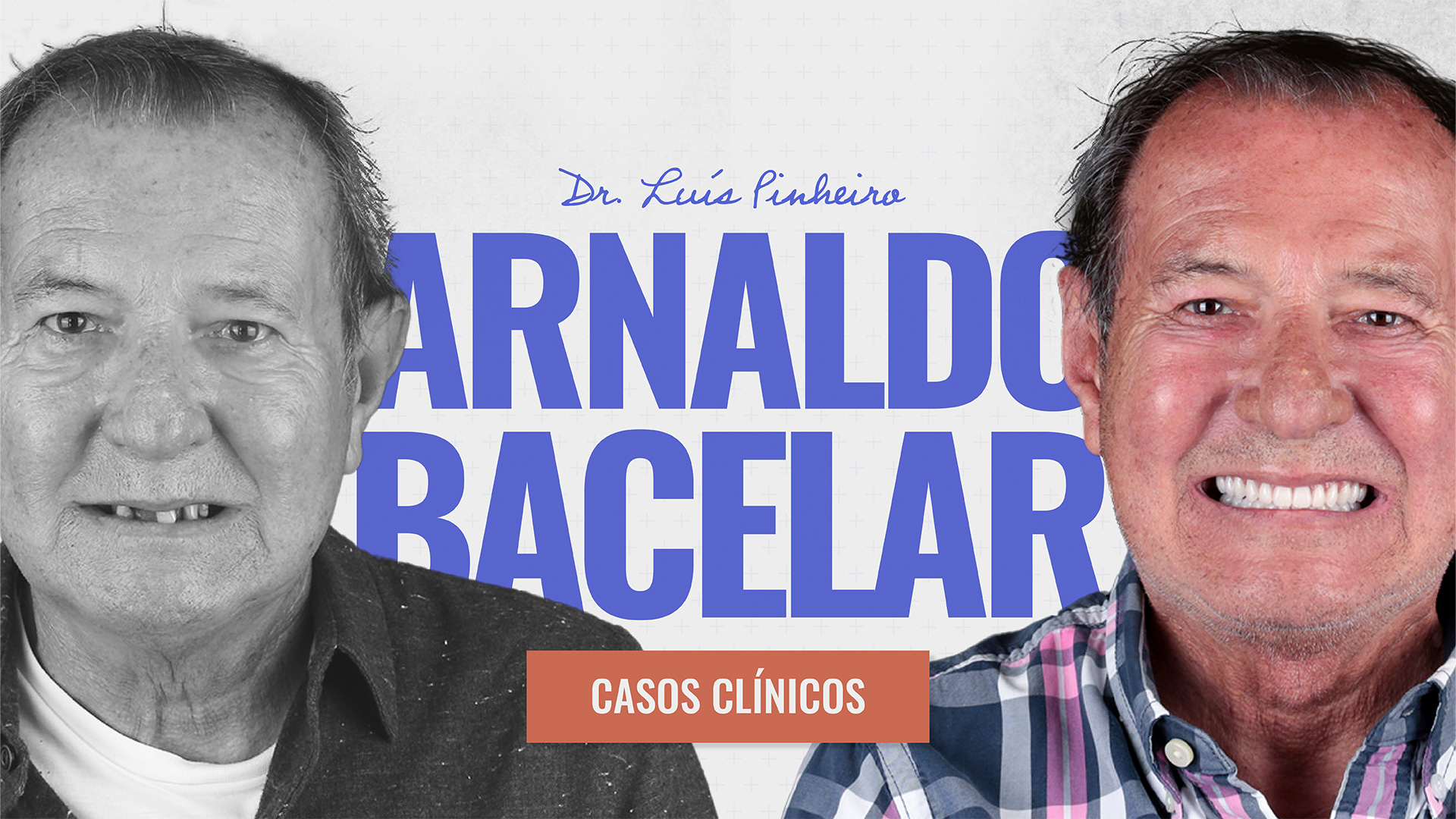 Caso Clínico – Arnaldo Bacelar