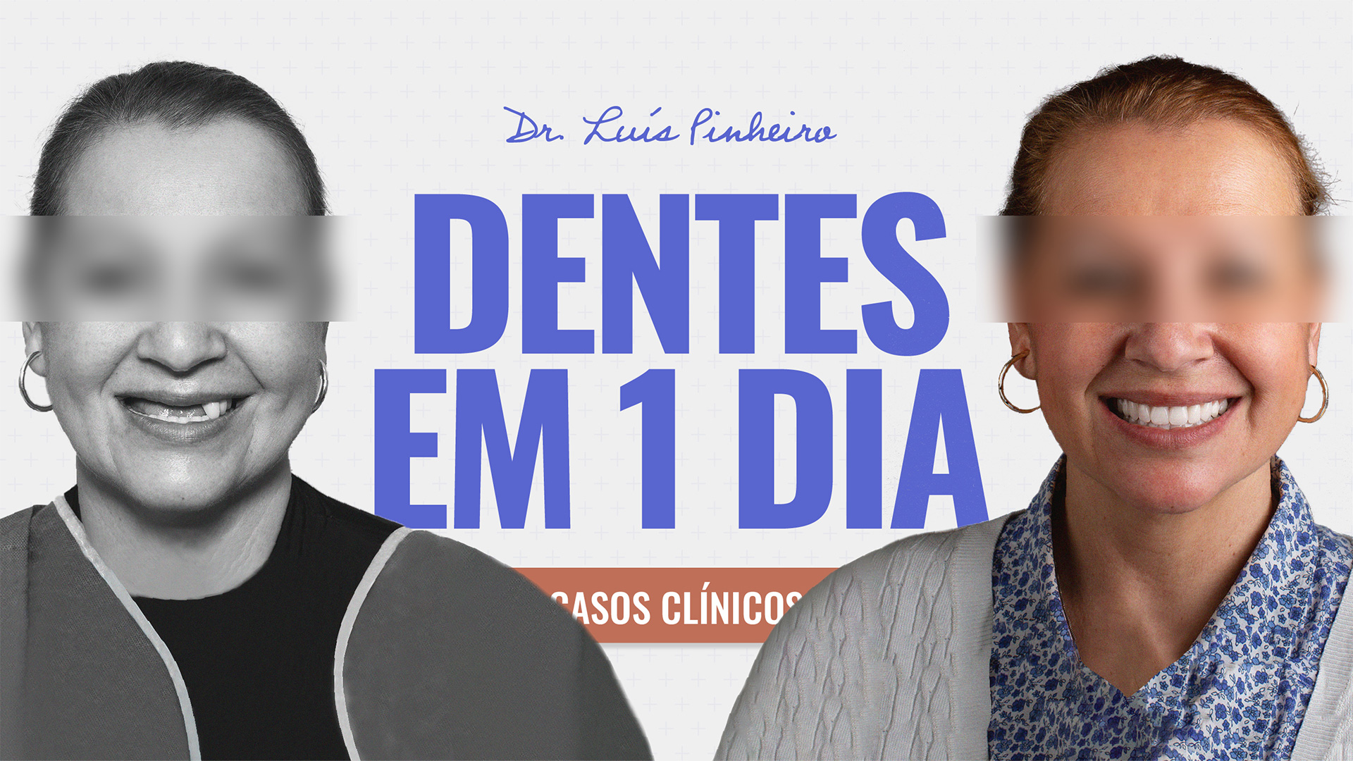 Caso clínico – Dentes em 1 dia | 5