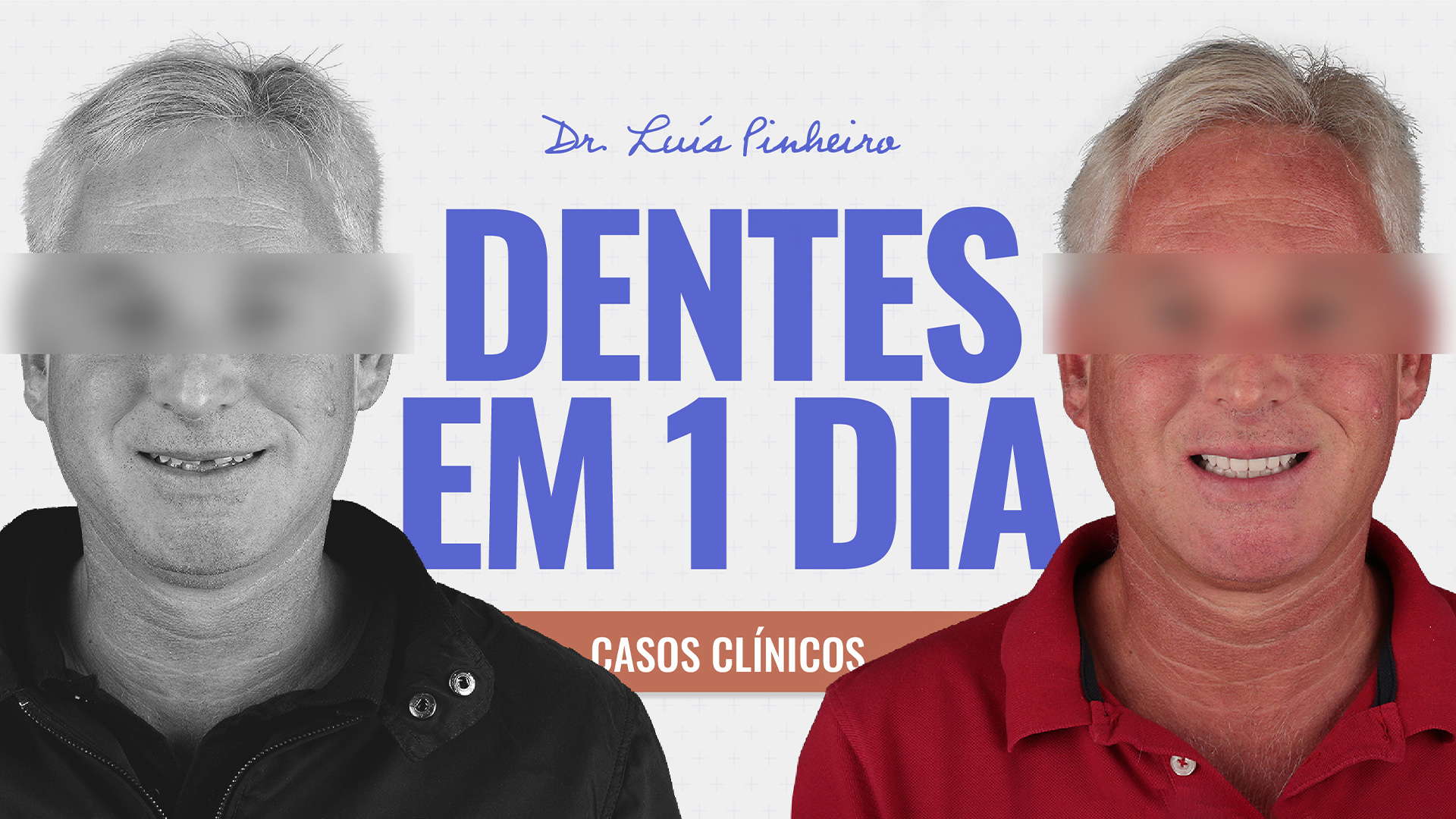 Caso Clínico - Dentes em 1 dia | 6