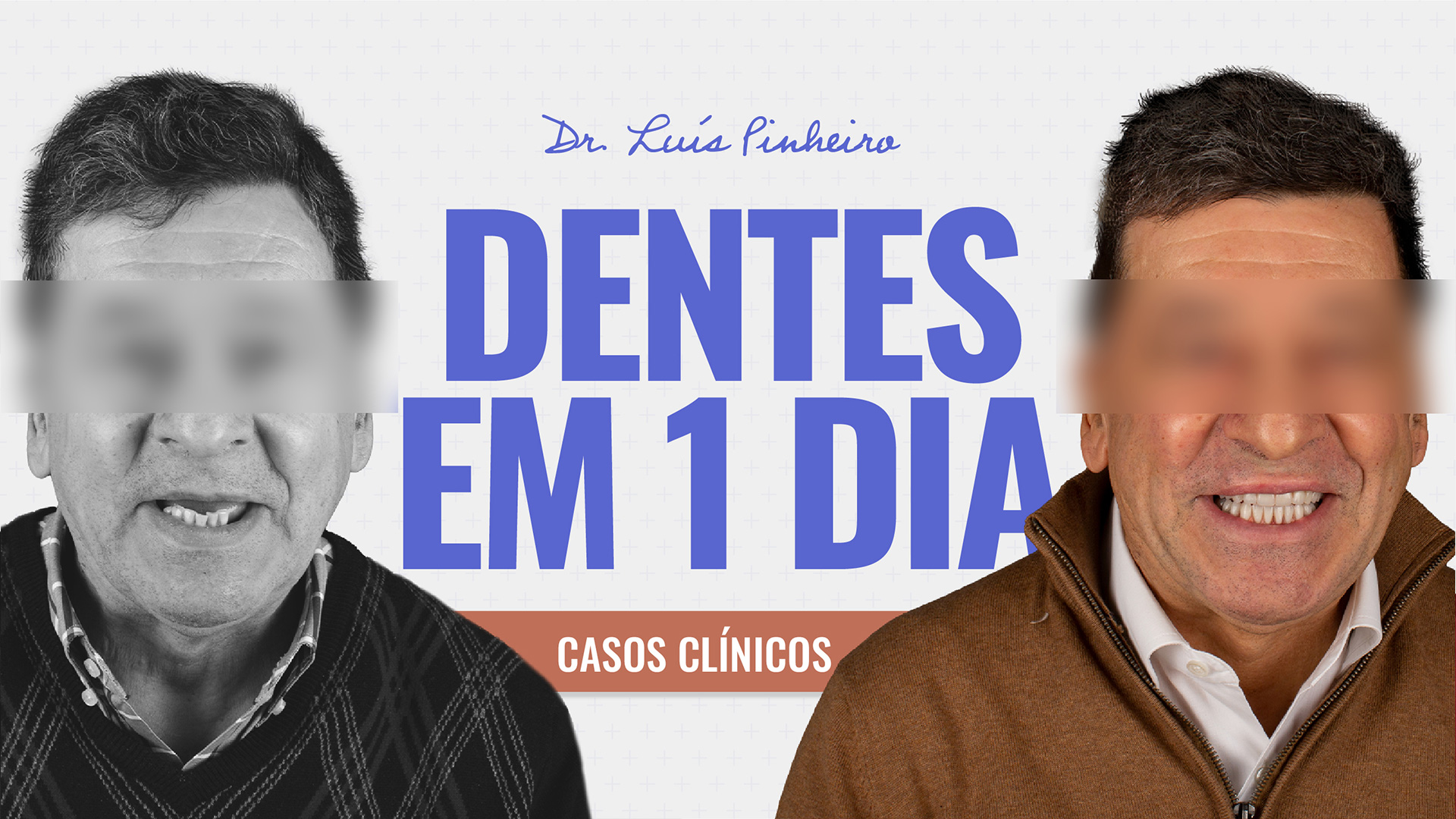 Caso Clínico – Dentes em 1 dia | 7