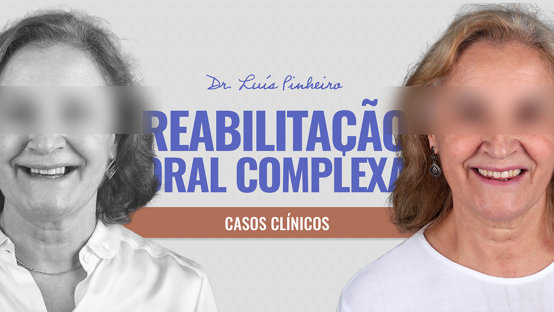 Caso Clínico - Reabilitação Oral Complexa | 5