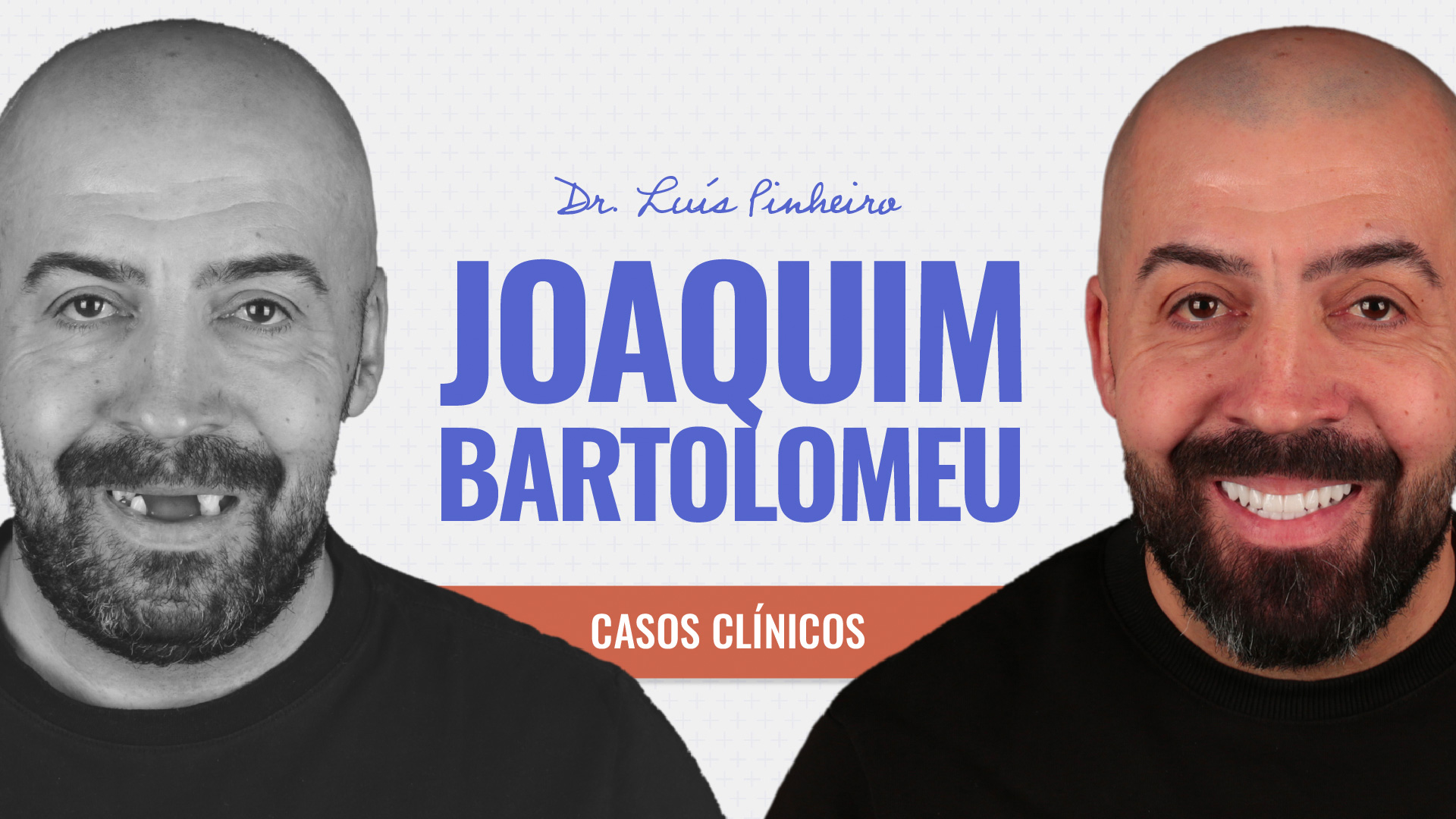 Caso clínico – Joaquim Bartolomeu